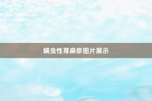螨虫性荨麻疹图片展示